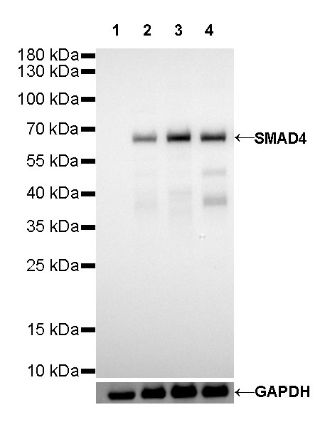 S-RMab® SMAD4 Recombinant Rabbit mAb (SDT-R114)