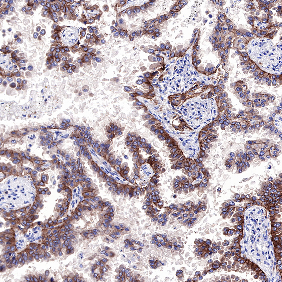 EGFR Recombinant Rabbit mAb (SDT-R110)