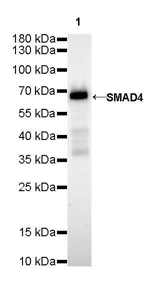 S-RMab® SMAD4 Recombinant Rabbit mAb (SDT-R114)