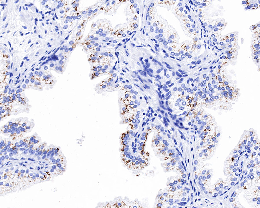 GP73/GOLPH2 Recombinant Rabbit mAb (SDT-231-102)