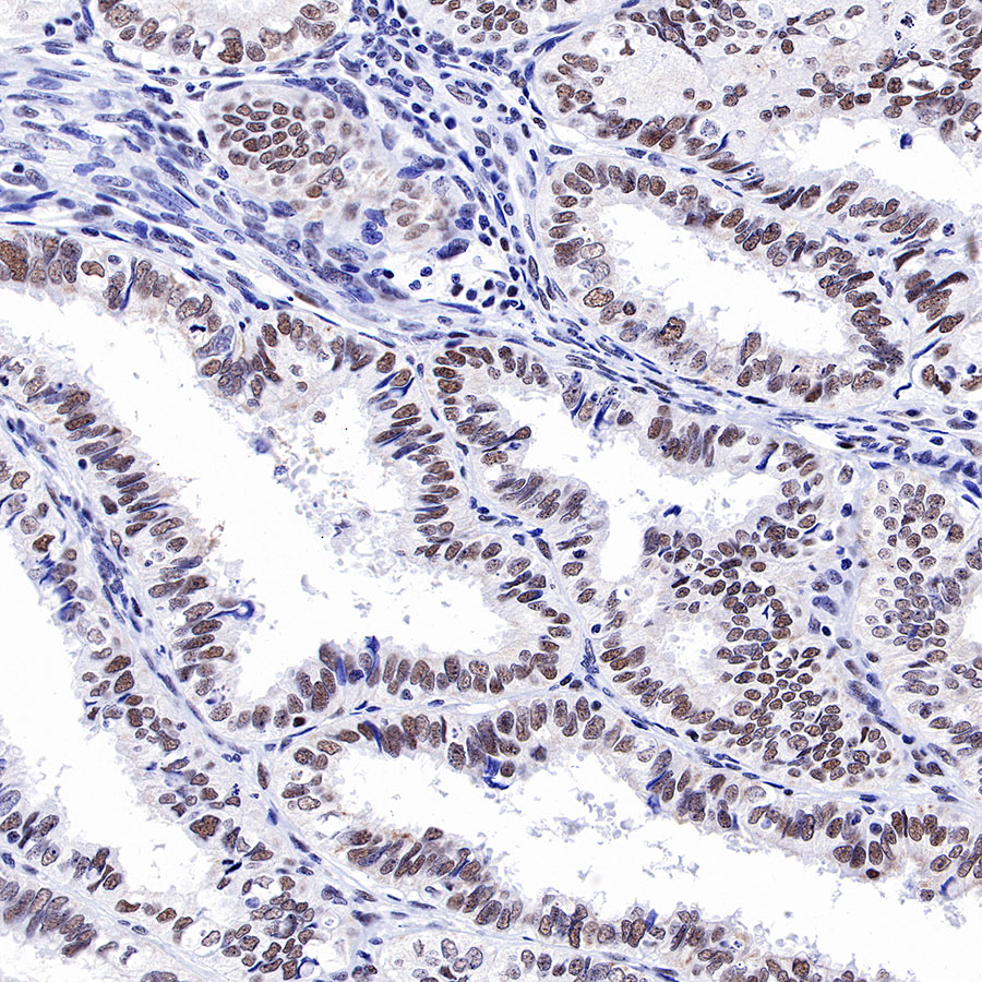 MSH2 Recombinant Rabbit mAb (SDT-037-20)