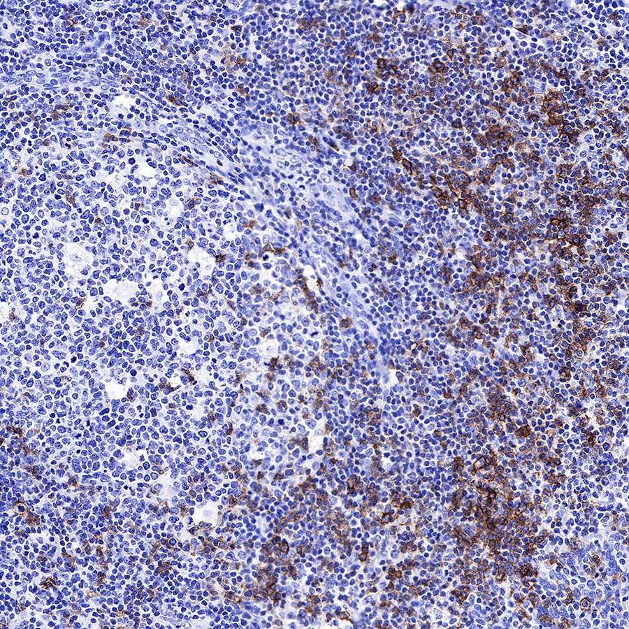 CD278/ICOS Recombinant Rabbit mAb (SDT-R104)