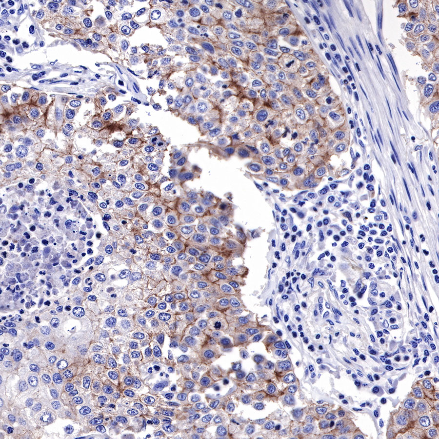 EGFR Recombinant Rabbit mAb (SDT-R110)