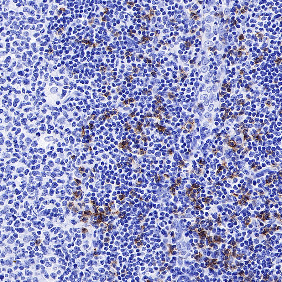 CD8α Recombinant Mouse mAb (SDT-126-8)