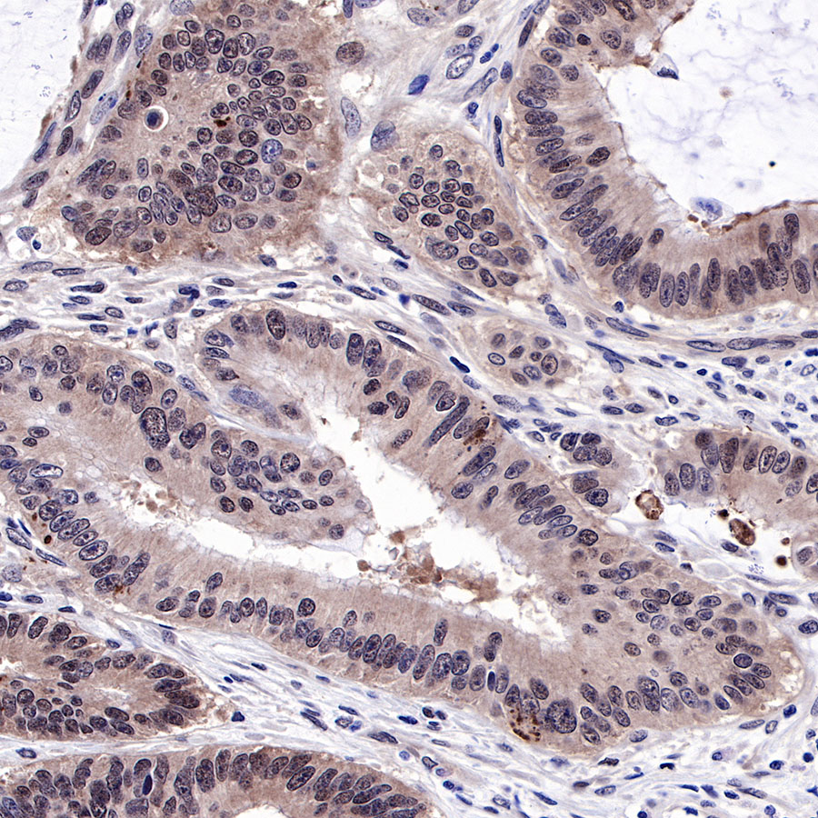 S-RMab® SMAD4 Recombinant Rabbit mAb (SDT-R114)