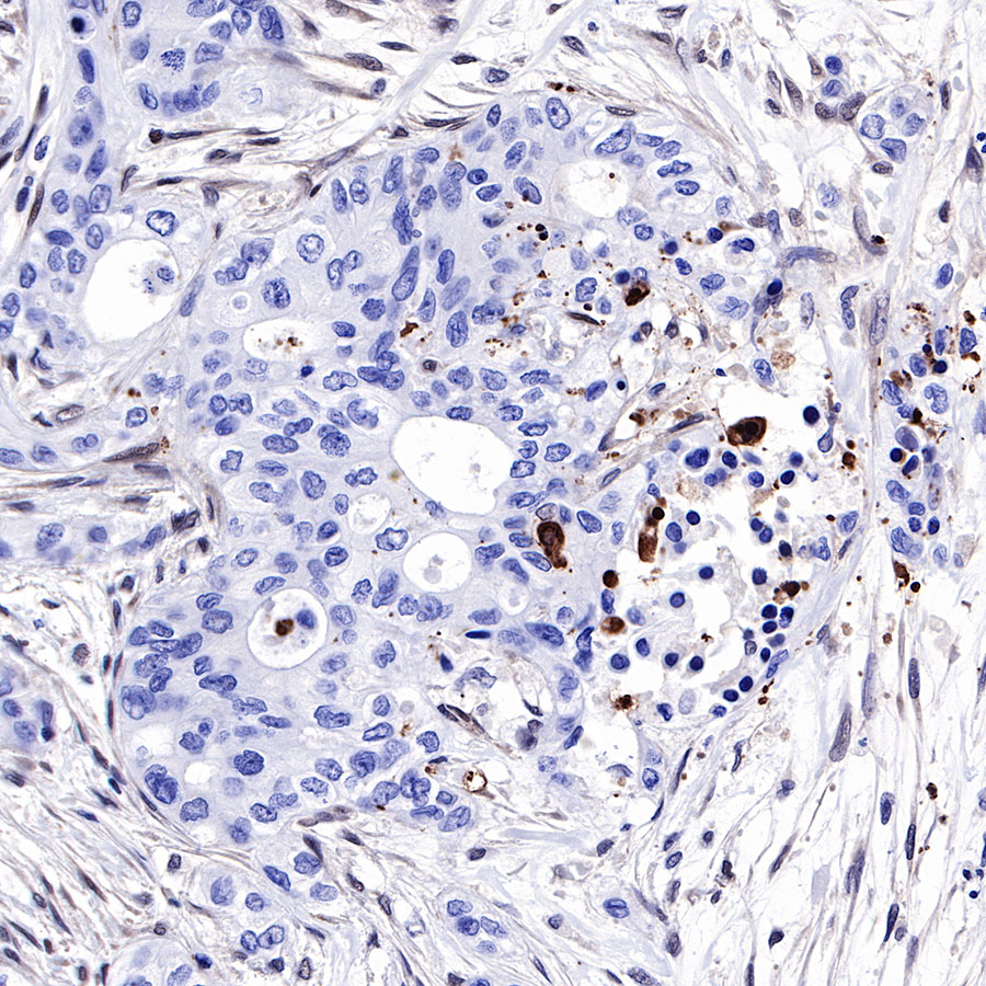 S-RMab® SMAD4 Recombinant Rabbit mAb (SDT-R114)