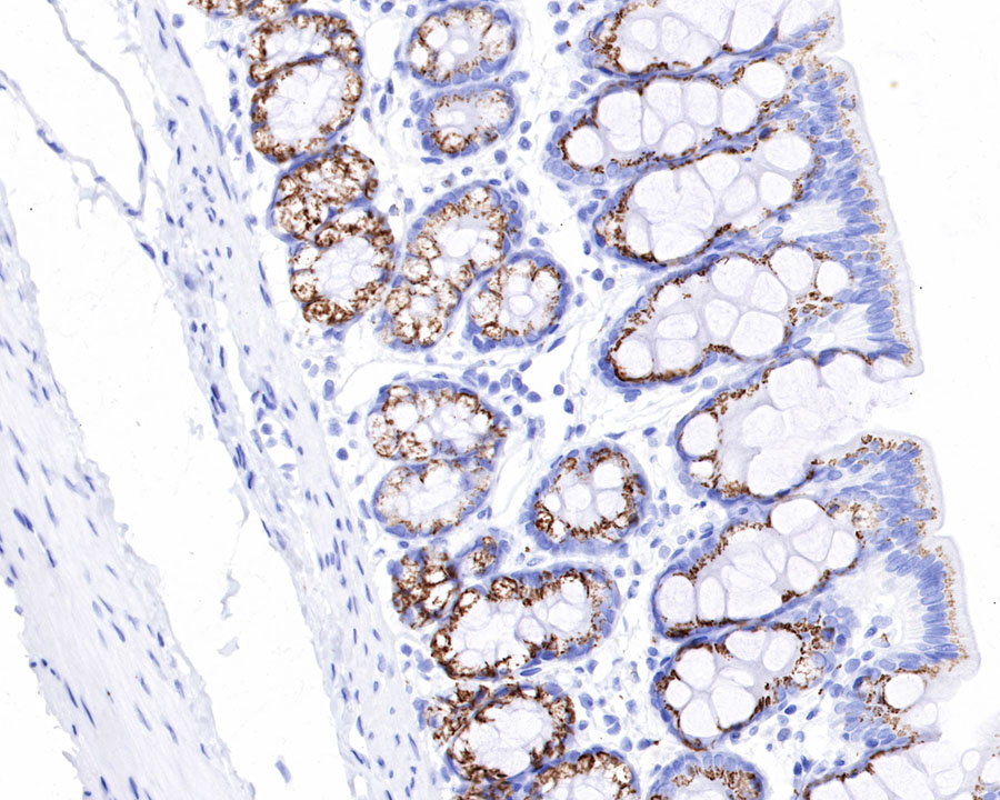 GP73/GOLPH2 Recombinant Rabbit mAb (SDT-231-102)