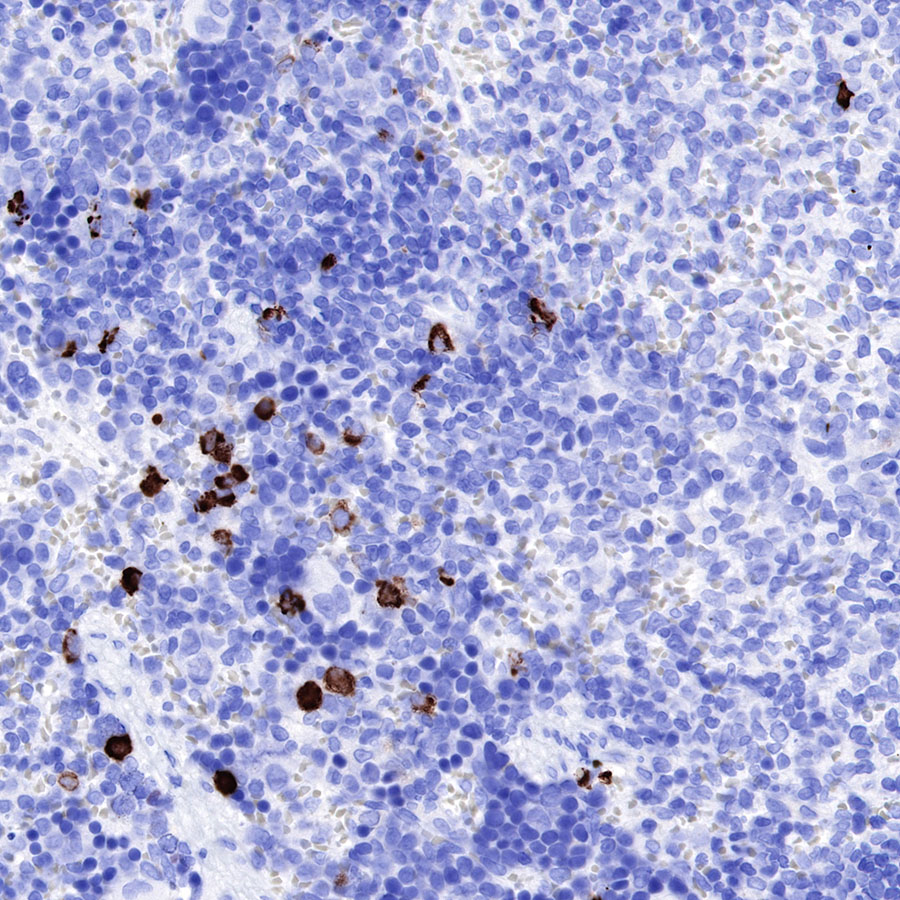 IGJ Recombinant Rabbit mAb (SDT-R128)