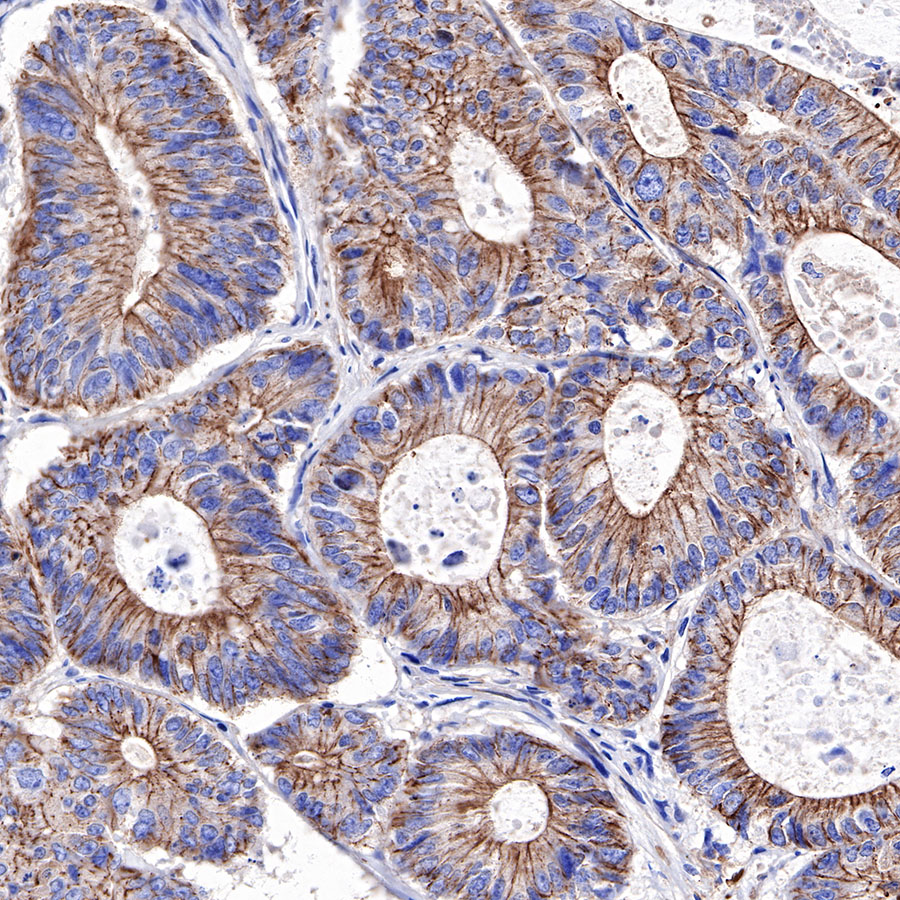 α-Actinin-1 Recombinant Rabbit mAb (SDT-311-20)