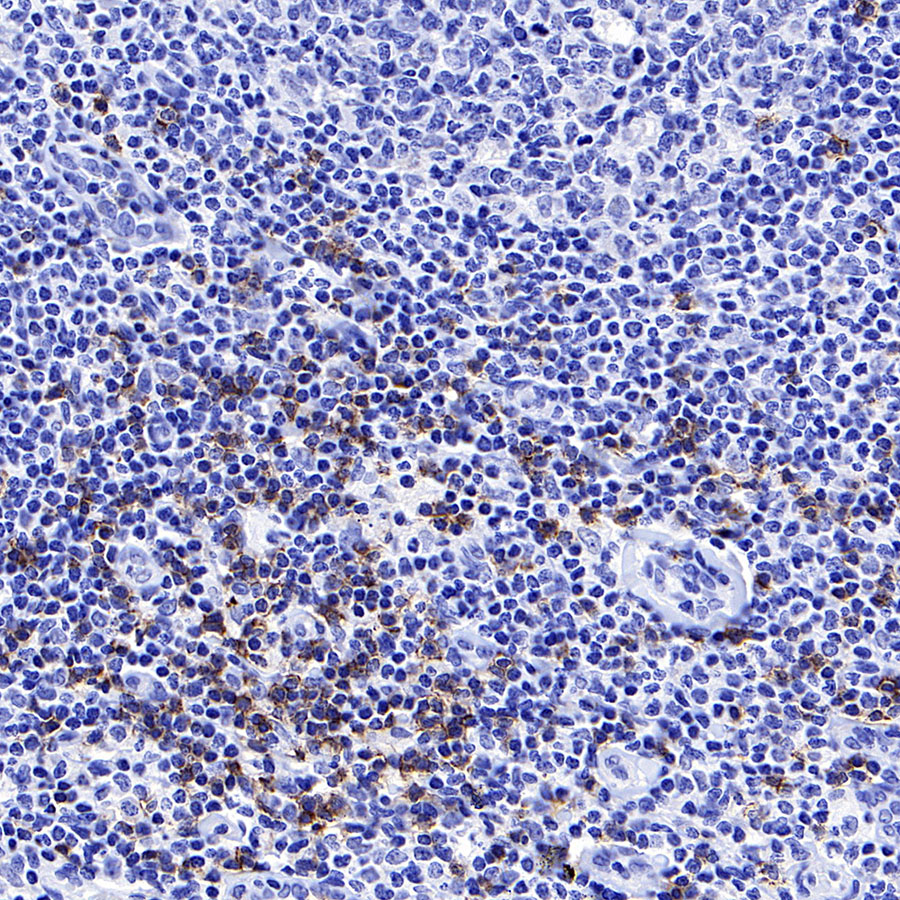 CD8α Recombinant Mouse mAb (SDT-126-8)