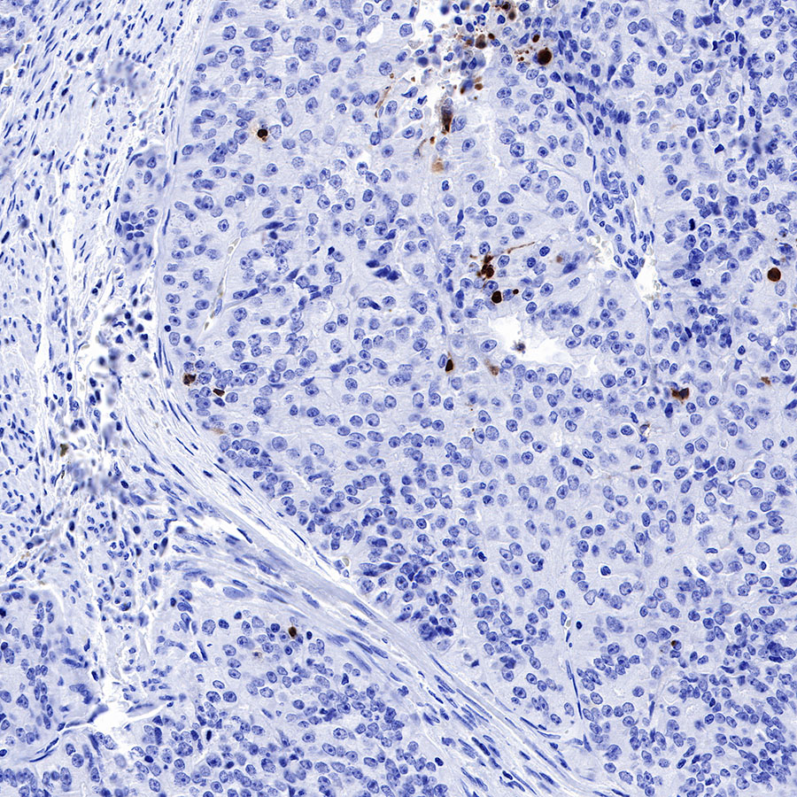 Cleaved PARP1 Recombinant Rabbit mAb,PBS Only (SDT-R084)