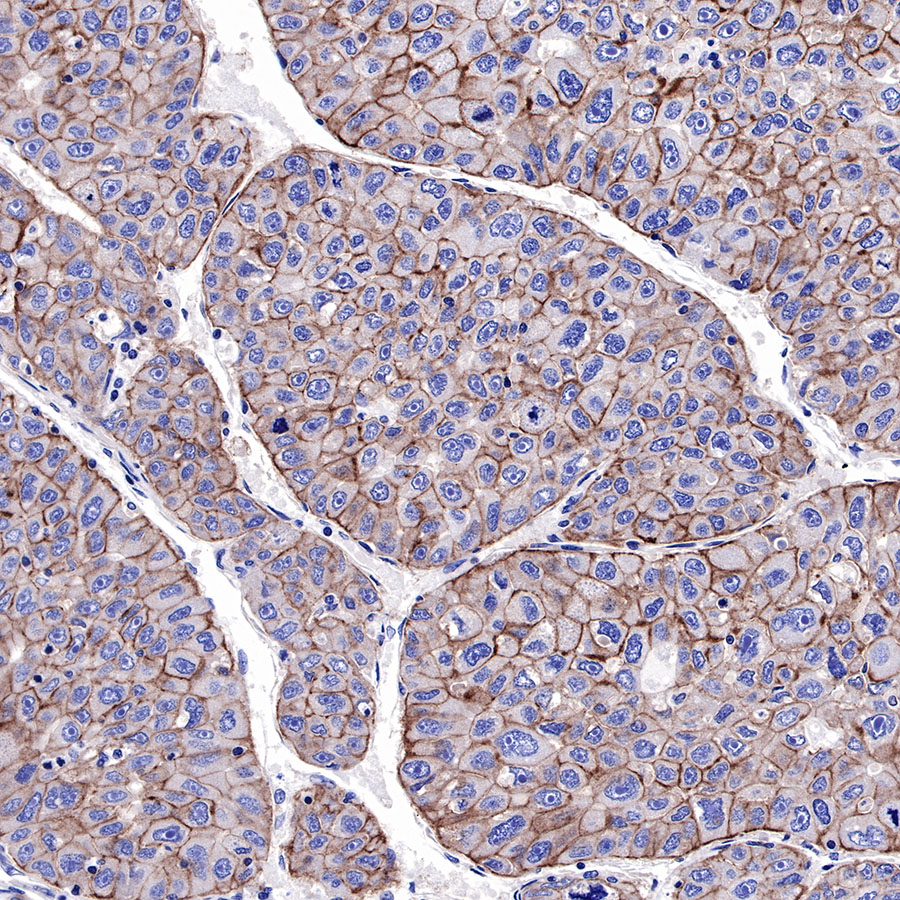 EGFR Recombinant Rabbit mAb (SDT-R110)